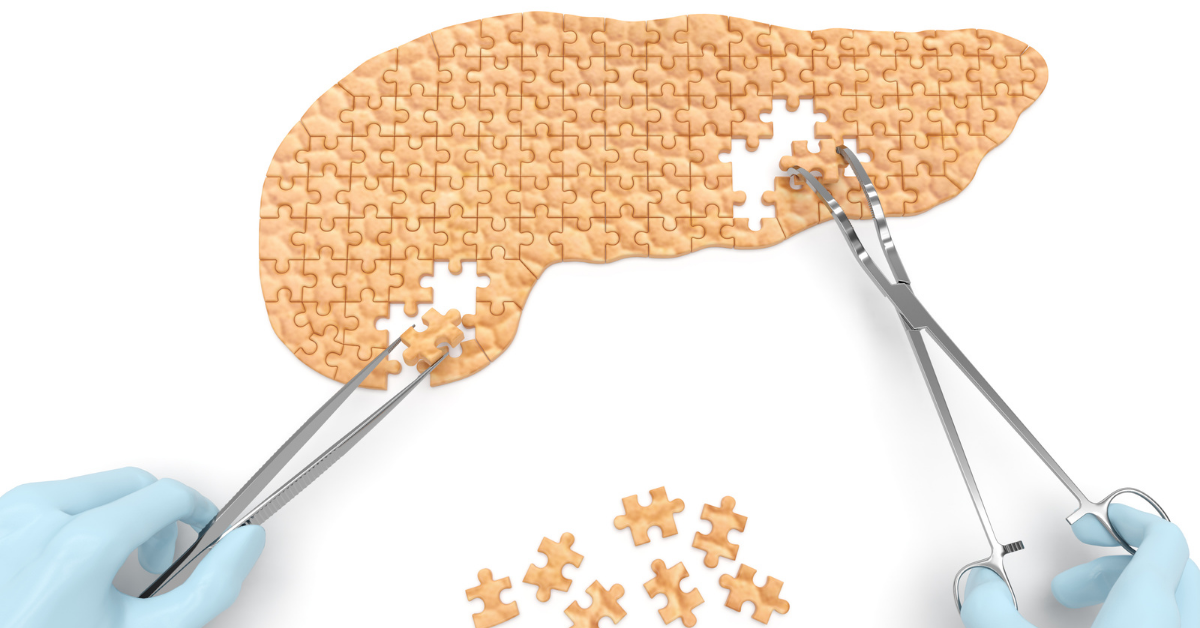 Pancreas-shaped puzzle