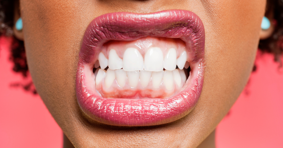 Woman showing her teeth