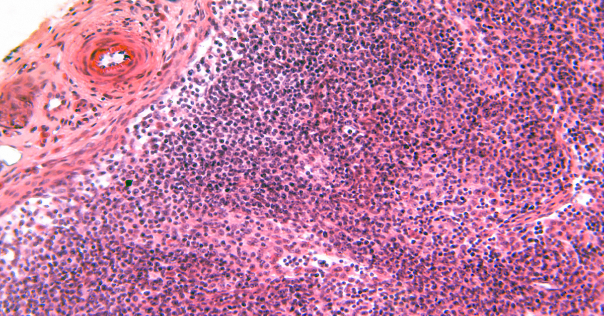 Microscopic view of a lymph node