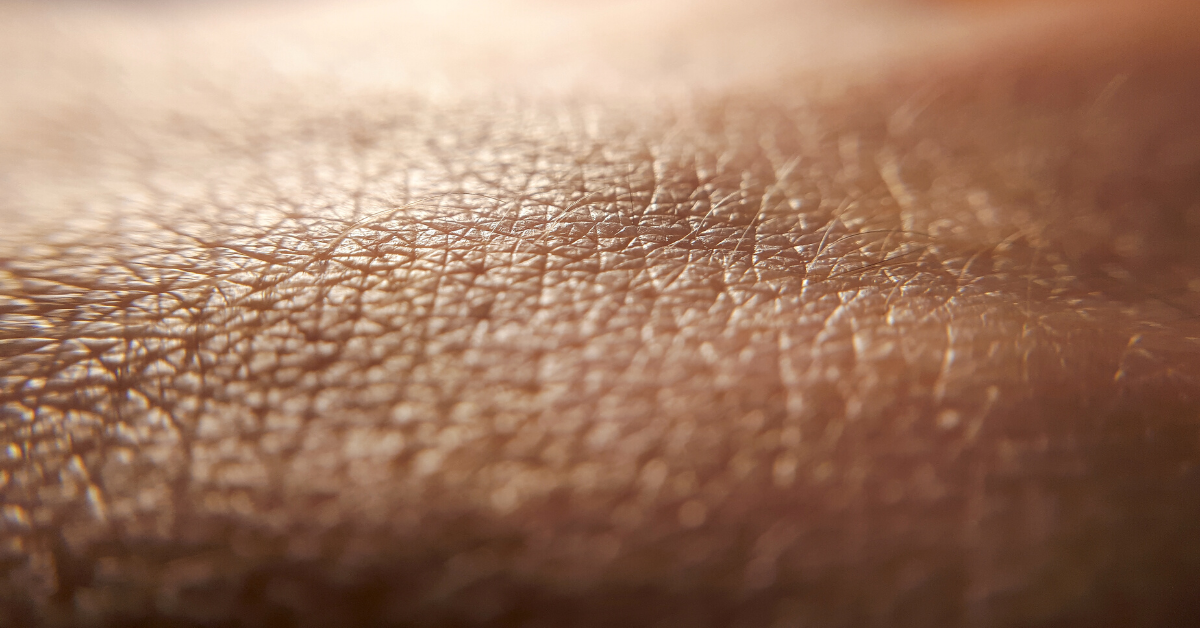 how-diabetes-can-affect-your-skin